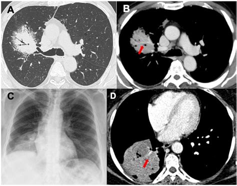 the villages lung ct scan|THE BEST 10 Diagnostic Imaging in THE VILLAGES, FL .